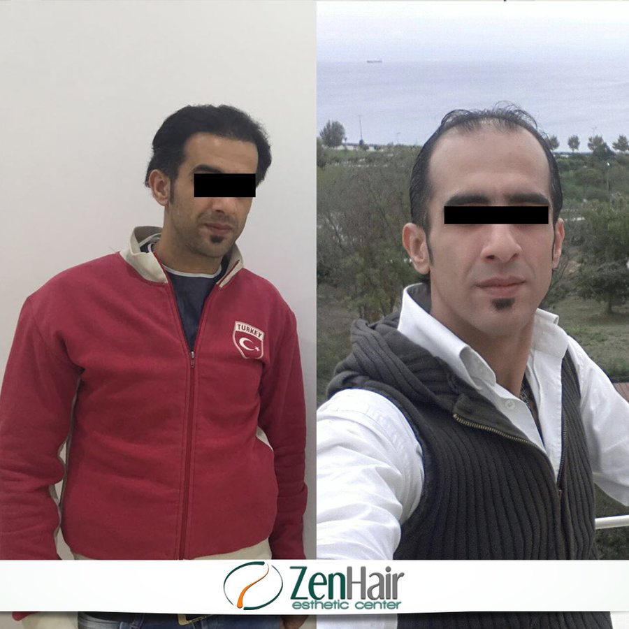 Zen Hair Esthetic Center - Zen Hair Esthetic Center