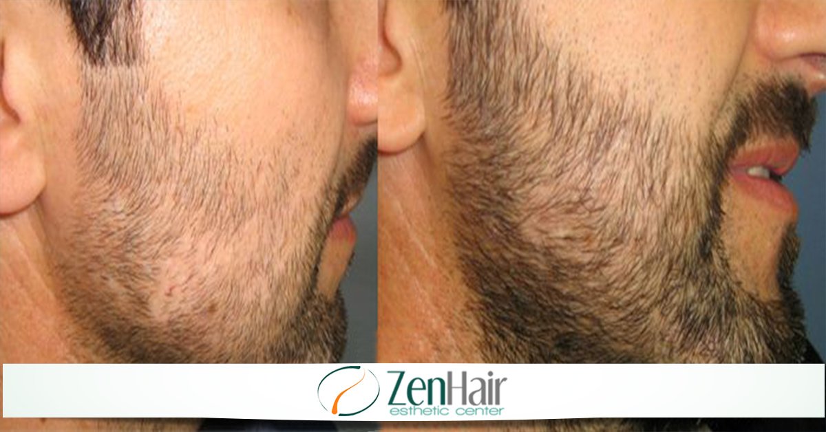 Zen Hair Esthetic Center - Zen Hair Esthetic Center