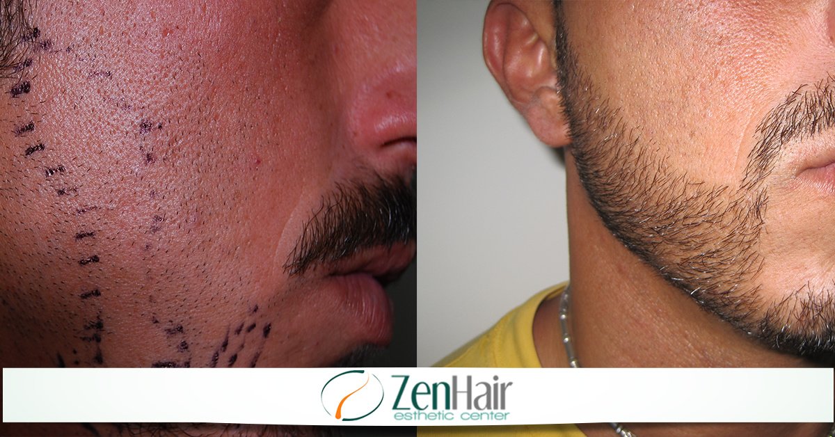 Zen Hair Esthetic Center - Zen Hair Esthetic Center