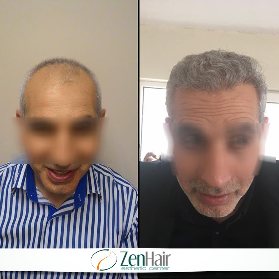 Zen Hair Esthetic Center - Zen Hair Esthetic Center