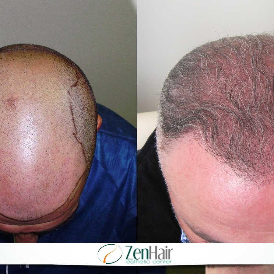 Zen Hair Esthetic Center - Zen Hair Esthetic Center