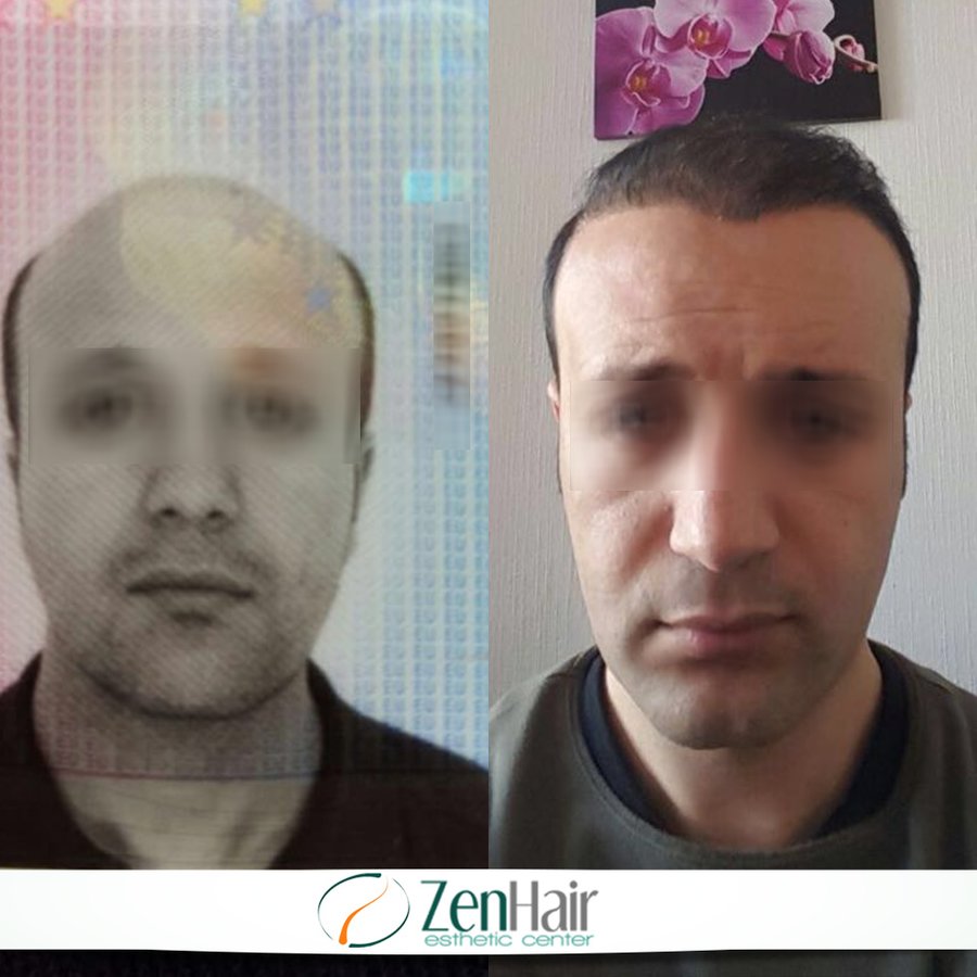 Zen Hair Esthetic Center - Zen Hair Esthetic Center