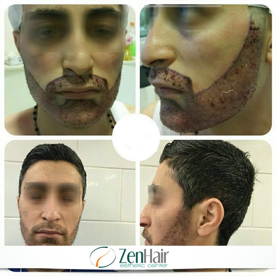 Zen Hair Esthetic Center - Zen Hair Esthetic Center