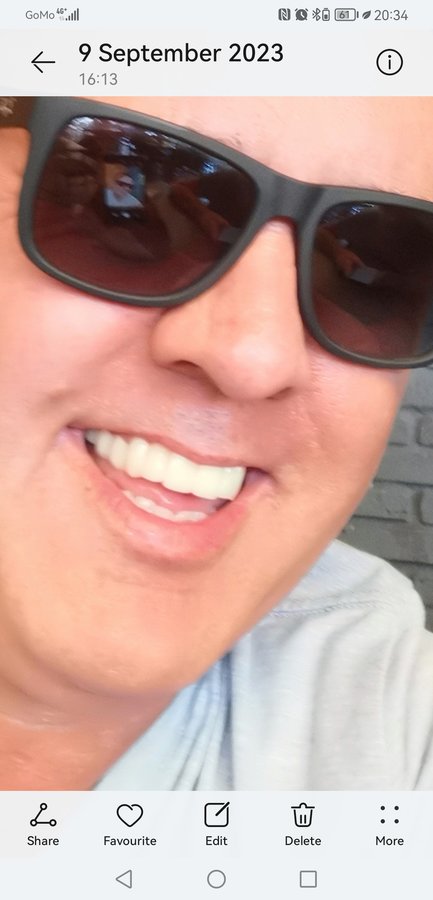 Zirve Dental Marmaris - Zirve Dental Marmaris