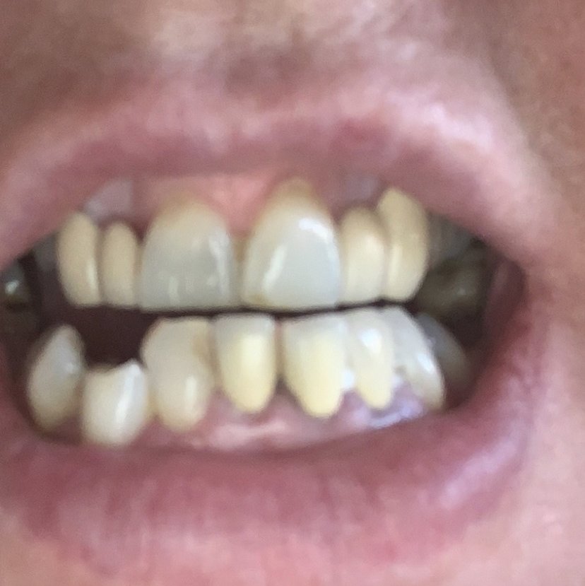 Zirve Dental Marmaris - Zirve Dental Marmaris